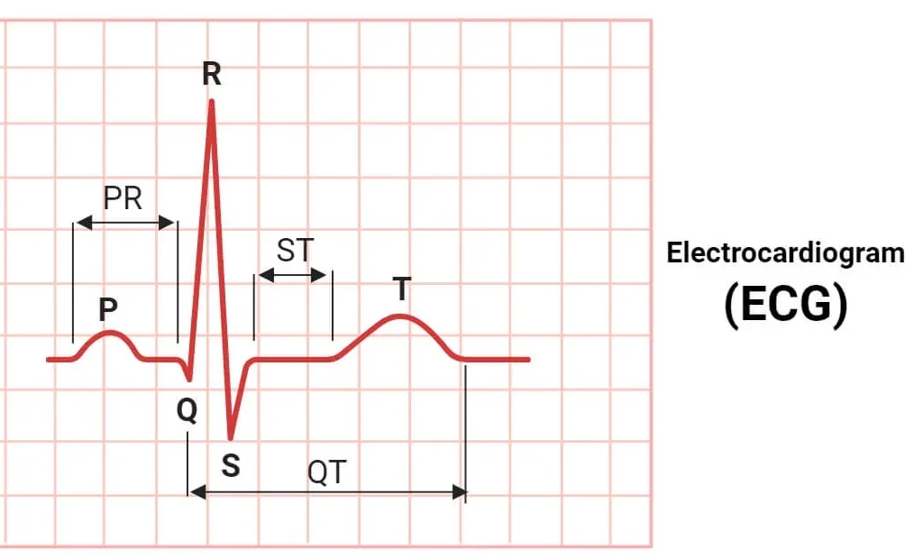 electrocardiogram ecg